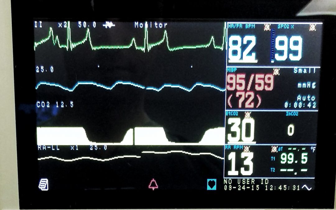 How dangerous is anesthesia for my pet?